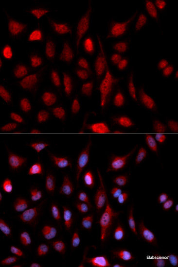 Immunohistochemistry of paraffin-embedded Human colon using FLT4 Polyclonal Antibody at dilution of  1:200 (40x lens).