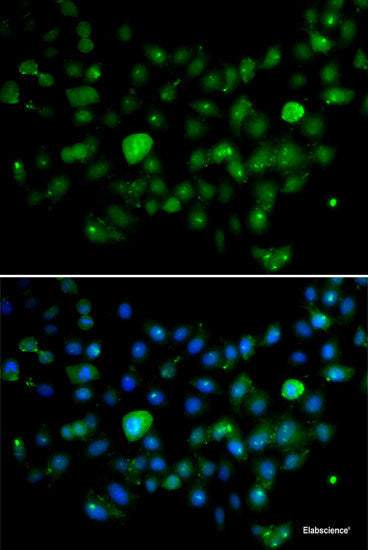 Western blot analysis of extracts of Mouse liver using ECE1 Polyclonal Antibody at dilution of 1:1000.