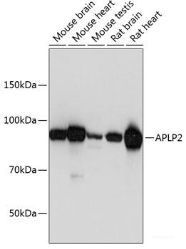 Immunohistochemistry of paraffin-embedded Rat brain using HTR2B Polyclonal Antibody at dilution of  1:100 (40x lens).