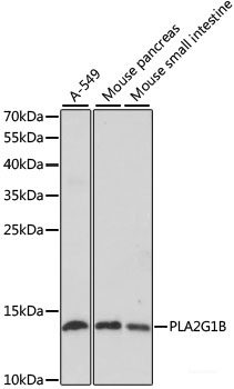 Immunohistochemistry of paraffin-embedded Rat brain using DOK1 Polyclonal Antibody at dilution of  1:100 (40x lens).