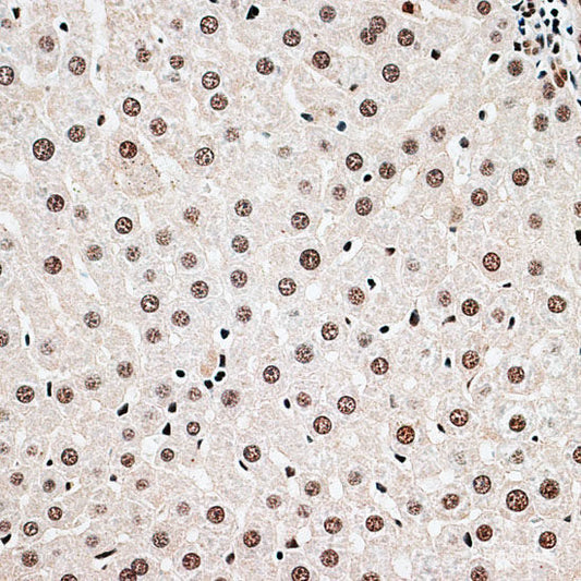 Immunofluorescence analysis of GFP-RNF168 transgenic U2OS cells using PIAS1 Polyclonal Antibody