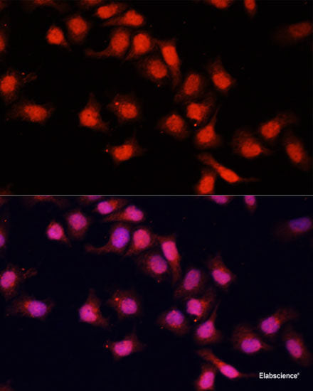 Immunohistochemistry of paraffin-embedded Rat heart using PRPF31 Polyclonal Antibody at dilution of  1:100 (40x lens).