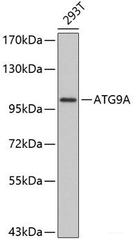 Immunohistochemistry of paraffin-embedded Mouse osteosarcoma using SMARCB1 Polyclonal Antibody at dilution of  1:200 (40x lens).