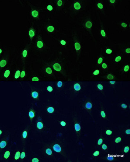 Immunohistochemistry of paraffin-embedded Rat lung using NFKBIB Polyclonal Antibody at dilution of  1:200 (40x lens).