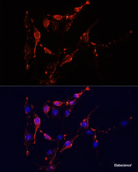 Immunohistochemistry of paraffin-embedded Human liver damage using PEX5 Polyclonal Antibody at dilution of  1:100 (40x lens).