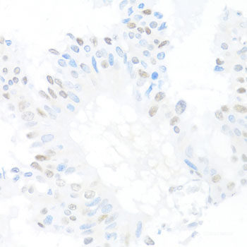 Immunohistochemistry of paraffin-embedded Mouse lung using CXXC1 Polyclonal Antibody at dilution of  1:200 (40x lens).