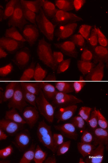 Immunohistochemistry of paraffin-embedded Rat kidney using DDX20 Polyclonal Antibody at dilution of  1:100 (40x lens).