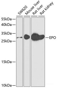 Immunohistochemistry of paraffin-embedded Human lung cancer using SMARCAD1 Polyclonal Antibody at dilution of  1:100 (40x lens).