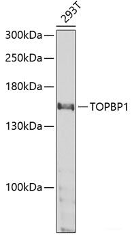Immunohistochemistry of paraffin-embedded Human breast cancer using CIRBP Polyclonal Antibody at dilution of  1:100 (40x lens).