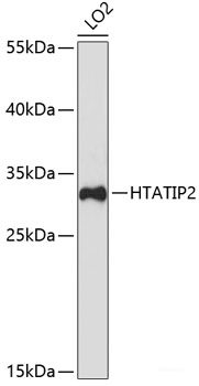 Immunohistochemistry of paraffin-embedded Mouse lung using SCNN1G Polyclonal Antibody at dilution of  1:100 (40x lens).