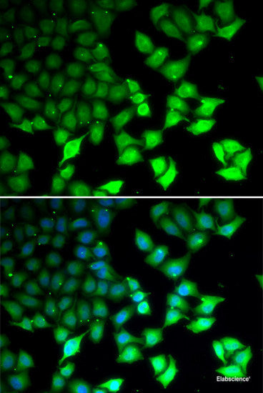 Immunofluorescence analysis of Rat brain using TRPM2 Polyclonal Antibody at dilution of  1:100. Blue: DAPI for nuclear staining.