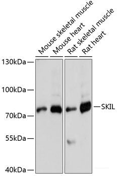 Immunohistochemistry of paraffin-embedded Human prostate using MYLIP Polyclonal Antibody at dilution of  1:100 (40x lens).