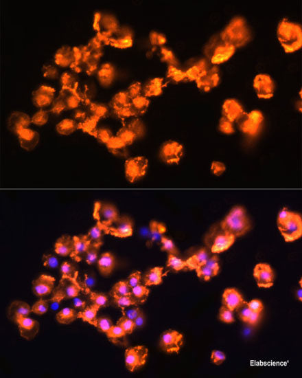 Immunohistochemistry of paraffin-embedded Rat spleen using CSF3 Polyclonal Antibody at dilution of  1:100 (40x lens).