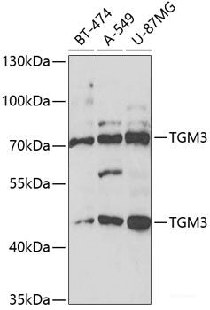 Immunohistochemistry of paraffin-embedded Human prostate using CXCL11 Polyclonal Antibody at dilution of  1:100 (40x lens).