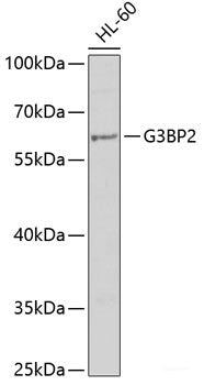 Immunohistochemistry of paraffin-embedded Rat heart using PLEK Polyclonal Antibody at dilution of  1:200 (40x lens).