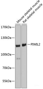 Immunohistochemistry of paraffin-embedded Rat lung using UBE2B Polyclonal Antibody at dilution of  1:100 (40x lens).