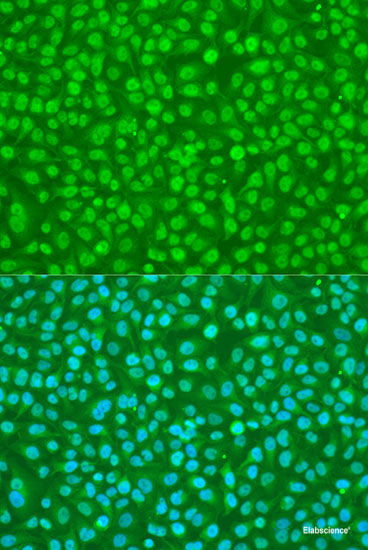 Immunohistochemistry of paraffin-embedded Rat kidney using BCAP29 Polyclonal Antibody at dilution of  1:100 (40x lens).