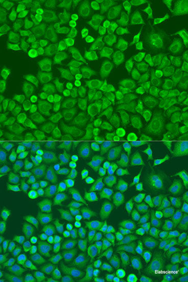 Immunohistochemistry of paraffin-embedded Rat brain using SYP Polyclonal Antibody at dilution of  1:100 (40x lens).