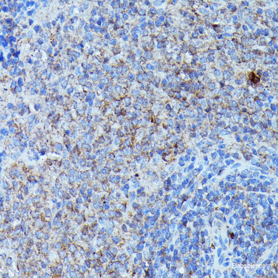 Immunohistochemistry of paraffin-embedded Rat kidney using PNLIP Polyclonal Antibody at dilution of  1:200 (40x lens).