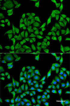 Immunohistochemistry of paraffin-embedded Rat brain using PTPN3 Polyclonal Antibody at dilution of  1:100 (40x lens).