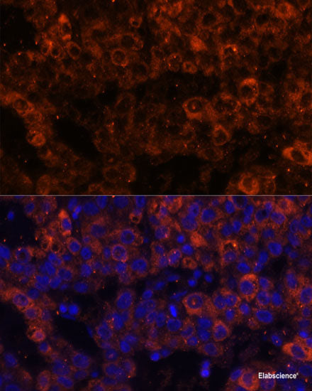 Immunohistochemistry of paraffin-embedded Mouse heart using SFRP4 Polyclonal Antibody at dilution of  1:100 (40x lens).