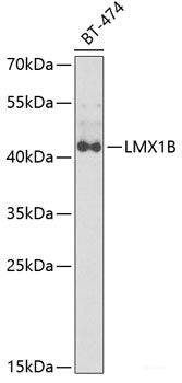 Immunohistochemistry of paraffin-embedded Mouse heart using CARS Polyclonal Antibody at dilution of  1:100 (40x lens).