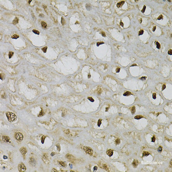Immunohistochemistry of paraffin-embedded Human prostate using COCH Polyclonal Antibody at dilution of  1:100 (40x lens).