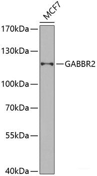 Immunohistochemistry of paraffin-embedded Human liver damage using SRI Polyclonal Antibody at dilution of  1:100 (40x lens).