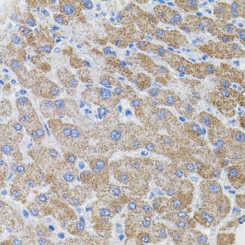 Immunohistochemistry of paraffin-embedded Mouse brain using CLCN7 Polyclonal Antibody at dilution of  1:100 (40x lens).