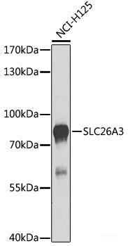Western blot analysis of extracts of various cell lines using POLR2H Polyclonal Antibody at dilution of 1:1000.