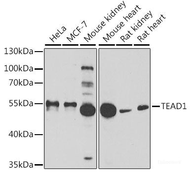 Immunohistochemistry of paraffin-embedded Human liver using CCL8 Polyclonal Antibody at dilution of  1:100 (40x lens).