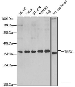 Immunohistochemistry of paraffin-embedded Rat kidney using SOX5 Polyclonal Antibody at dilution of  1:100 (40x lens).