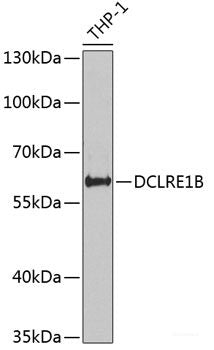 Immunohistochemistry of paraffin-embedded Rat lung using ZNF148 Polyclonal Antibody at dilution of  1:100 (40x lens).