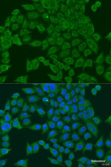 Immunohistochemistry of paraffin-embedded Rat lung using NAA10 Polyclonal Antibody at dilution of  1:100 (40x lens).
