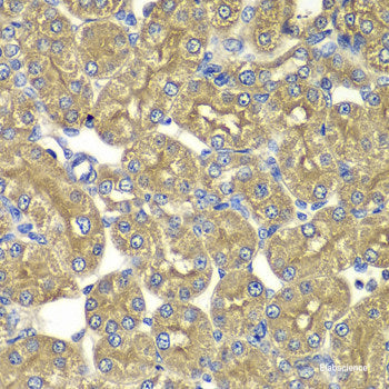 Immunohistochemistry of paraffin-embedded Rat kidney using LAP3 Polyclonal Antibody at dilution of  1:100 (40x lens).