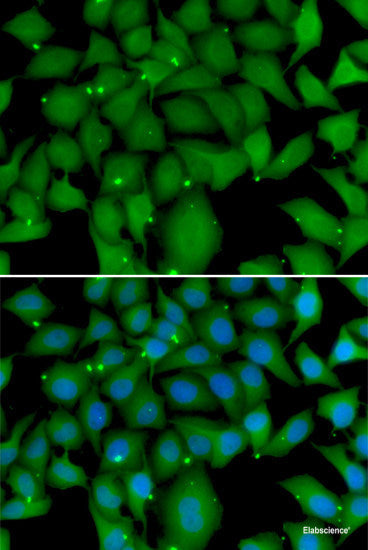 Immunohistochemistry of paraffin-embedded Human prostate cancer using PEX14 Polyclonal Antibody at dilution of  1:100 (40x lens).