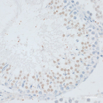 Immunofluorescence analysis of C6 cells using Acetyl-Histone H4-K91 Polyclonal Antibody at dilution of  1:100.C6 cells were treated by TSA (1 uM) at 37℃ for 18 hours. Blue: DAPI for nuclear staining.