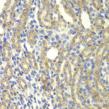 Immunofluorescence analysis of U2OS cells using CENPK Polyclonal Antibody at dilution of  1:100. Blue: DAPI for nuclear staining.