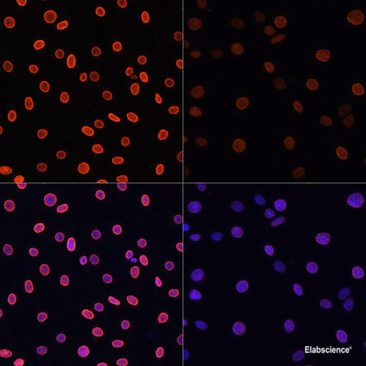 Western blot analysis of extracts of various cell lines using UBIAD1 Polyclonal Antibody at dilution of 1:1000.