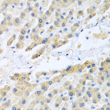 Immunofluorescence analysis of U2OS cells using ZFYVE16 Polyclonal Antibody at dilution of  1:100. Blue: DAPI for nuclear staining.