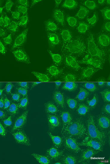 Immunofluorescence analysis of HeLa cells using ACADVL Polyclonal Antibody at dilution of  1:100 (40x lens). Blue: DAPI for nuclear staining.