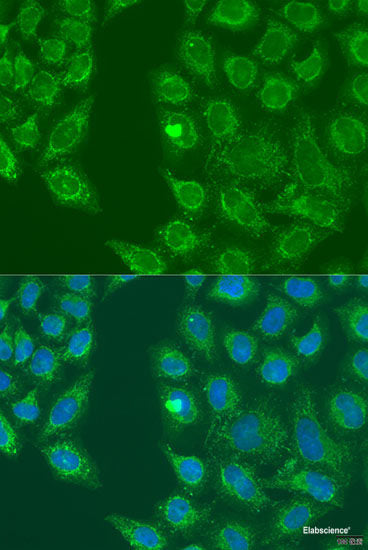 Immunofluorescence analysis of HeLa cells using ACADVL Polyclonal Antibody at dilution of  1:100 (40x lens). Blue: DAPI for nuclear staining.