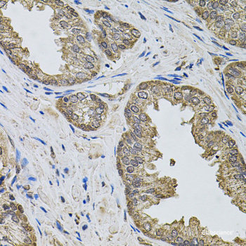 Immunohistochemistry of paraffin-embedded Human prostate using ACO1 Polyclonal Antibody at dilution of  1:100 (40x lens).