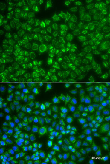 Western blot analysis of extracts of Mouse lung using WNT9A Polyclonal Antibody at dilution of 1:1000.