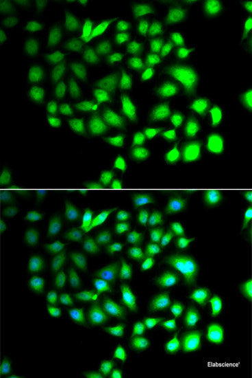 Immunofluorescence analysis of A549 cells using MLF1 Polyclonal Antibody