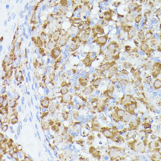 Immunohistochemistry of paraffin-embedded Rat kidney using HMGCL Polyclonal Antibody at dilution of  1:100 (40x lens).