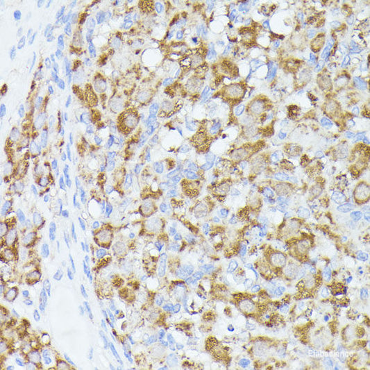 Immunohistochemistry of paraffin-embedded Rat kidney using HMGCL Polyclonal Antibody at dilution of  1:100 (40x lens).