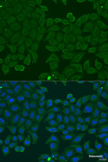 Immunohistochemistry of paraffin-embedded Rat lung using ARSF Polyclonal Antibody at dilution of  1:100 (40x lens).