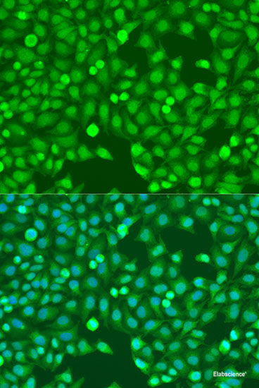 Immunohistochemistry of paraffin-embedded Mouse brain using CDH11 Polyclonal Antibody at dilution of  1:100 (40x lens).