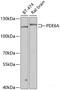 Immunohistochemistry of paraffin-embedded Rat lung using CST4 Polyclonal Antibody at dilution of  1:100 (40x lens).